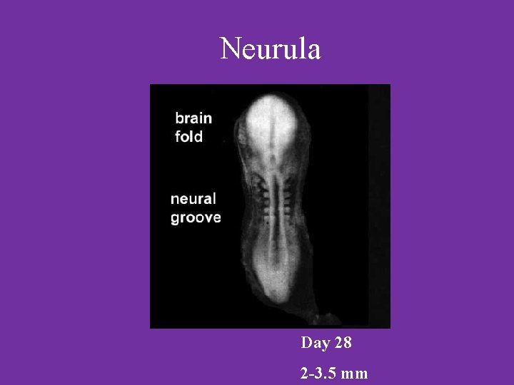 Neurula Day 28 2 -3. 5 mm 