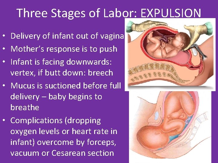 Three Stages of Labor: EXPULSION • Delivery of infant out of vagina • Mother’s