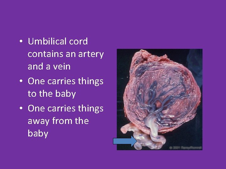  • Umbilical cord contains an artery and a vein • One carries things