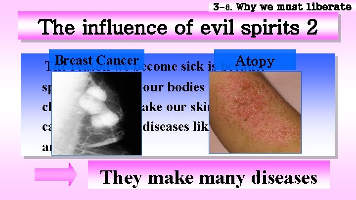 3 -8. Why we must liberate The influence of evil spirits 2 Breast Cancer