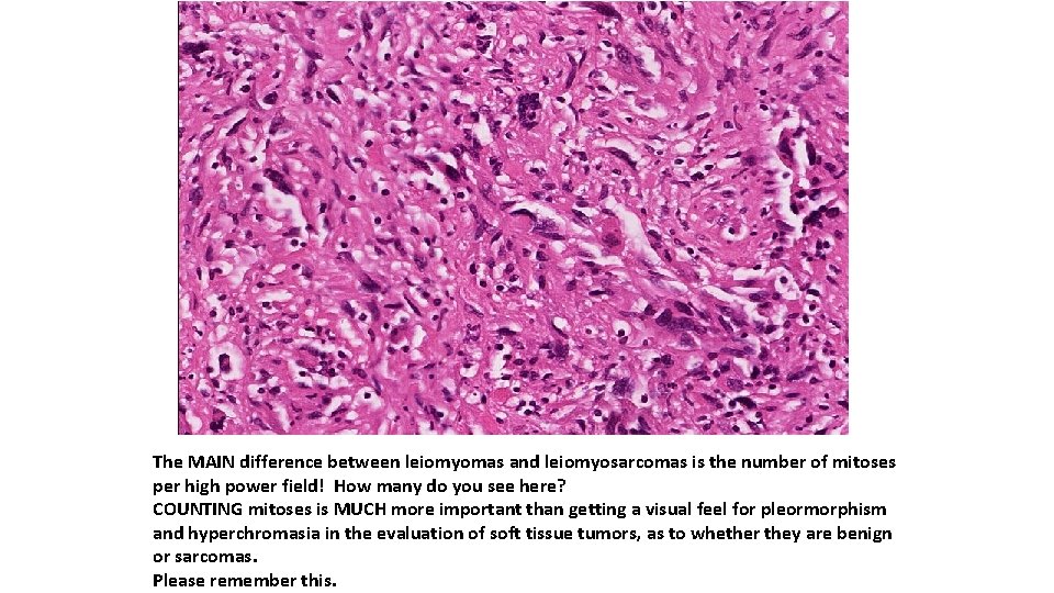 The MAIN difference between leiomyomas and leiomyosarcomas is the number of mitoses per high