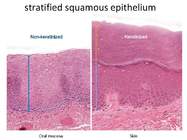 stratified squamous epithelium Oral mucosa Skin 