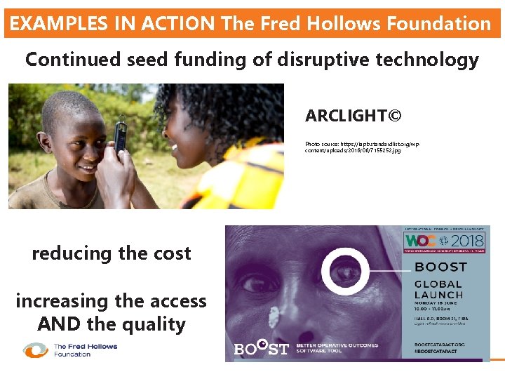 EXAMPLES IN ACTION The Fred Hollows Foundation Continued seed funding of disruptive technology ARCLIGHT©