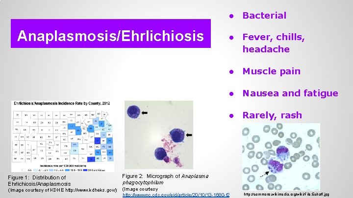 ● Bacterial Anaplasmosis/Ehrlichiosis ● Fever, chills, headache ● Muscle pain ● Nausea and fatigue