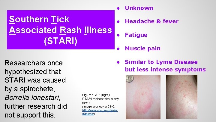 ● Unknown Southern Tick Associated Rash Illness (STARI) Researchers once hypothesized that STARI was