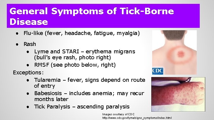 General Symptoms of Tick-Borne Disease ● Flu-like (fever, headache, fatigue, myalgia) ● Rash ●