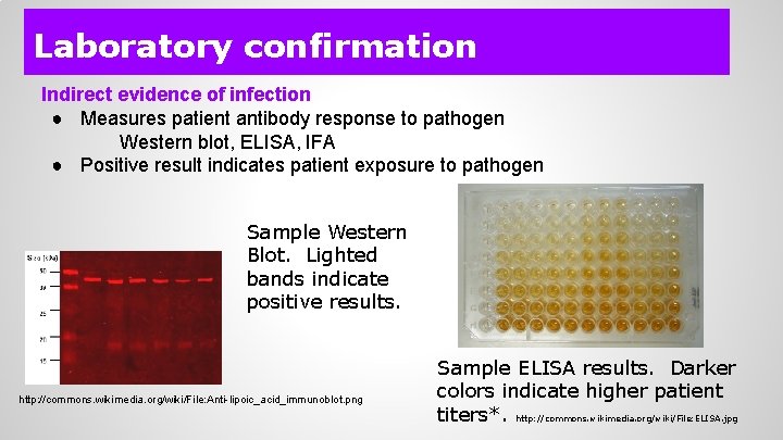 Laboratory confirmation Indirect evidence of infection ● Measures patient antibody response to pathogen Western