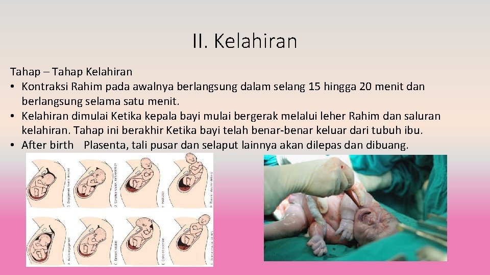 II. Kelahiran Tahap – Tahap Kelahiran • Kontraksi Rahim pada awalnya berlangsung dalam selang