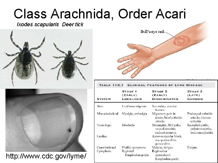 Class Arachnida, Order Acari Ixodes scapularis Deer tick http: //www. cdc. gov/lyme/ Lyme disease