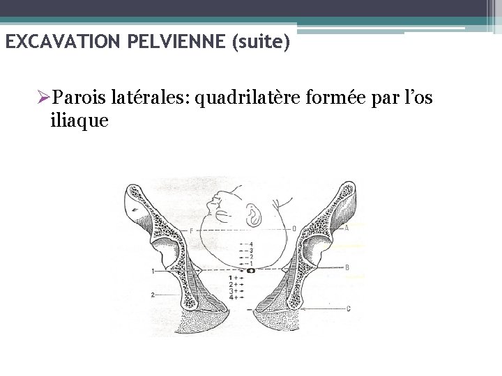 EXCAVATION PELVIENNE (suite) ØParois latérales: quadrilatère formée par l’os iliaque 