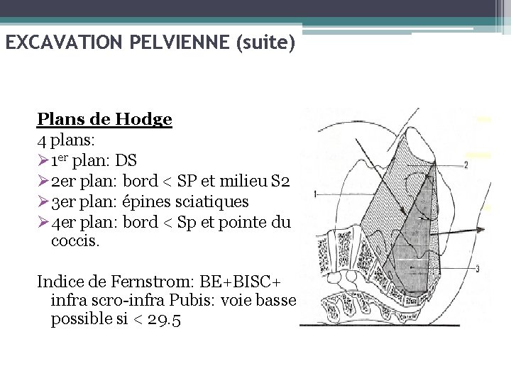 EXCAVATION PELVIENNE (suite) Plans de Hodge 4 plans: Ø 1 er plan: DS Ø