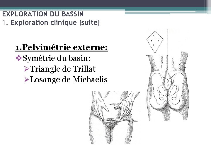 EXPLORATION DU BASSIN 1. Exploration clinique (suite) 1. Pelvimétrie externe: v. Symétrie du basin: