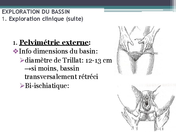 EXPLORATION DU BASSIN 1. Exploration clinique (suite) 1. Pelvimétrie externe: v. Info dimensions du