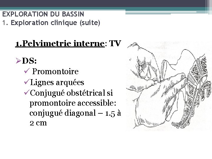 EXPLORATION DU BASSIN 1. Exploration clinique (suite) 1. Pelvimetrie interne: TV ØDS: ü Promontoire