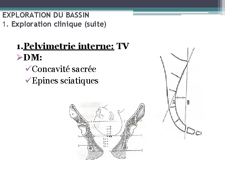 EXPLORATION DU BASSIN 1. Exploration clinique (suite) 1. Pelvimetrie interne: TV ØDM: üConcavité sacrée