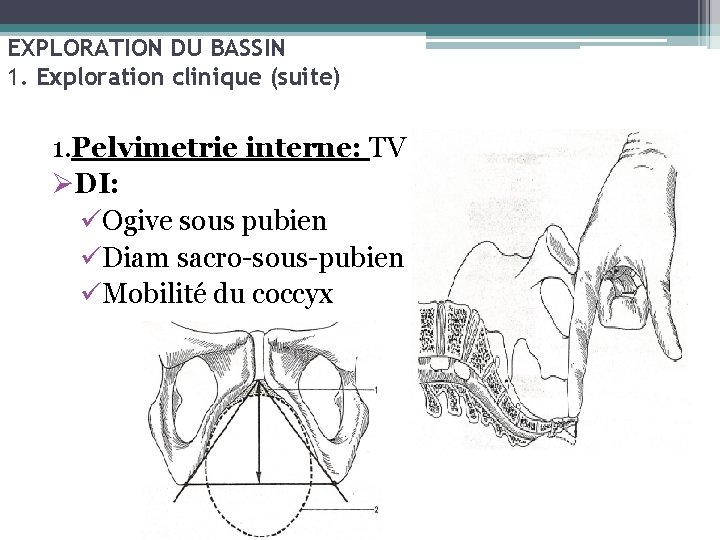 EXPLORATION DU BASSIN 1. Exploration clinique (suite) 1. Pelvimetrie interne: TV ØDI: üOgive sous