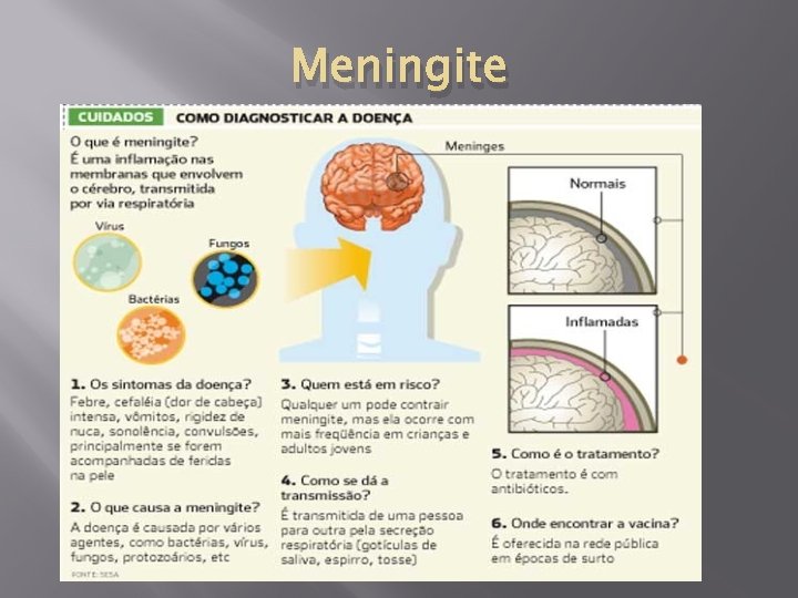 Meningite 