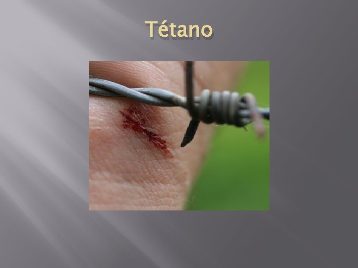 Tétano 