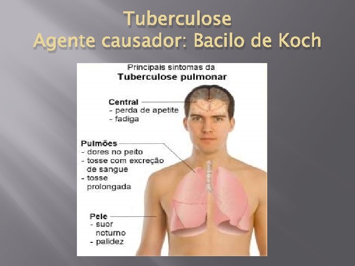 Tuberculose Agente causador: Bacilo de Koch 