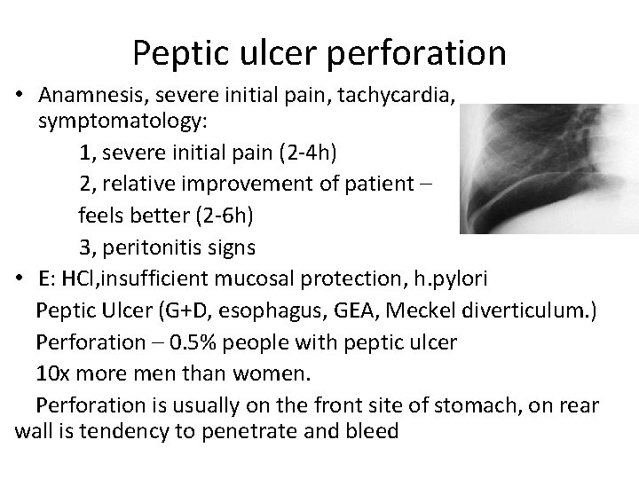 Peptic ulcer perforation • Anamnesis, severe initial pain, tachycardia, symptomatology: 1, severe initial pain