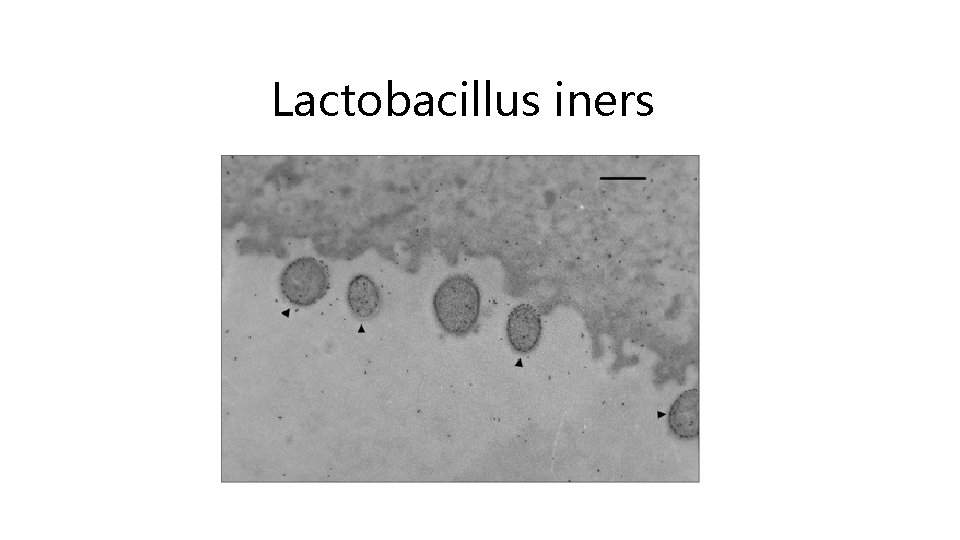 Lactobacillus iners 
