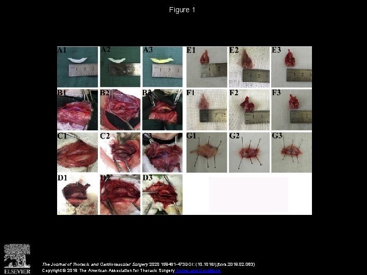 Figure 1 The Journal of Thoracic and Cardiovascular Surgery 2020 159461 -473 DOI: (10.