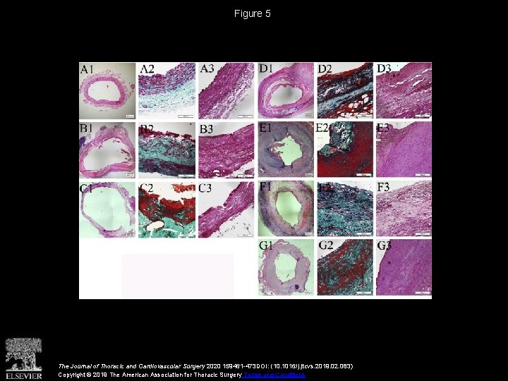 Figure 5 The Journal of Thoracic and Cardiovascular Surgery 2020 159461 -473 DOI: (10.