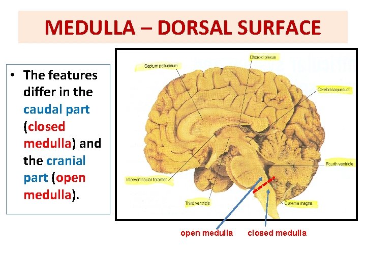 MEDULLA – DORSAL SURFACE • The features differ in the caudal part (closed medulla)