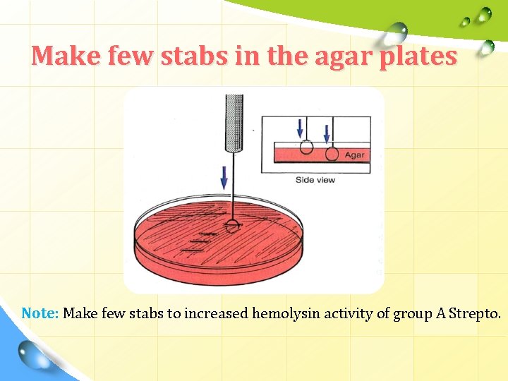 Make few stabs in the agar plates Note: Make few stabs to increased hemolysin