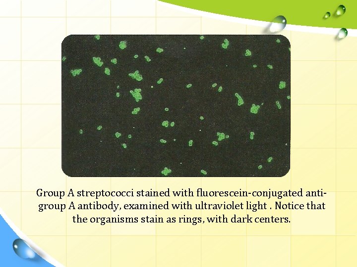 Group A streptococci stained with fluorescein-conjugated antigroup A antibody, examined with ultraviolet light. Notice