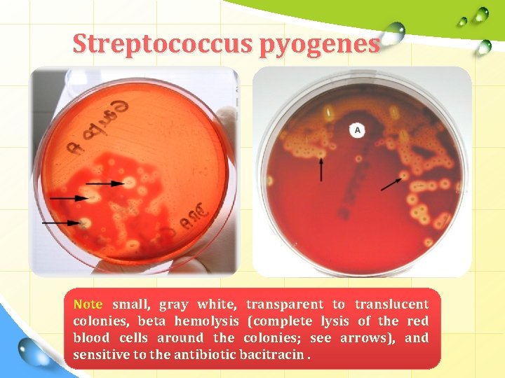 Streptococcus pyogenes Note small, gray white, transparent to translucent colonies, beta hemolysis (complete lysis