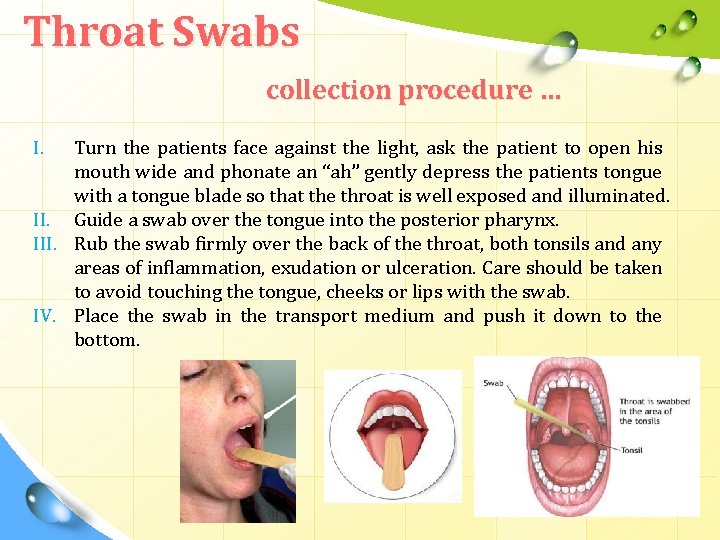 Throat Swabs collection procedure … I. Turn the patients face against the light, ask