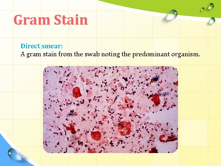 Gram Stain Direct smear: A gram stain from the swab noting the predominant organism.