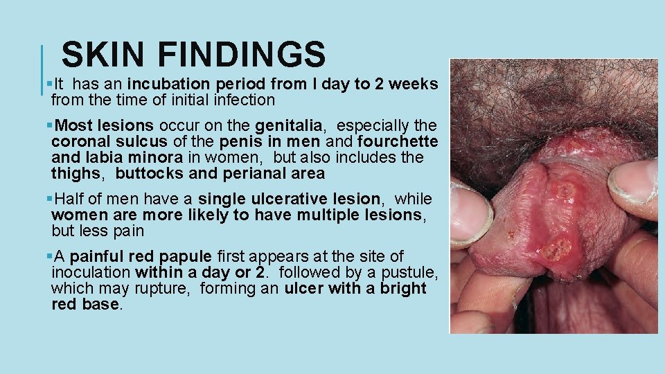 SKIN FINDINGS §It has an incubation period from l day to 2 weeks from