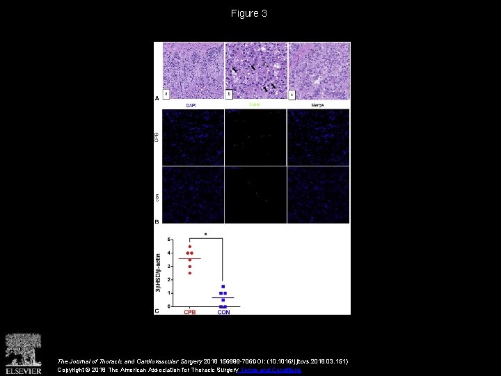 Figure 3 The Journal of Thoracic and Cardiovascular Surgery 2018 156696 -706 DOI: (10.