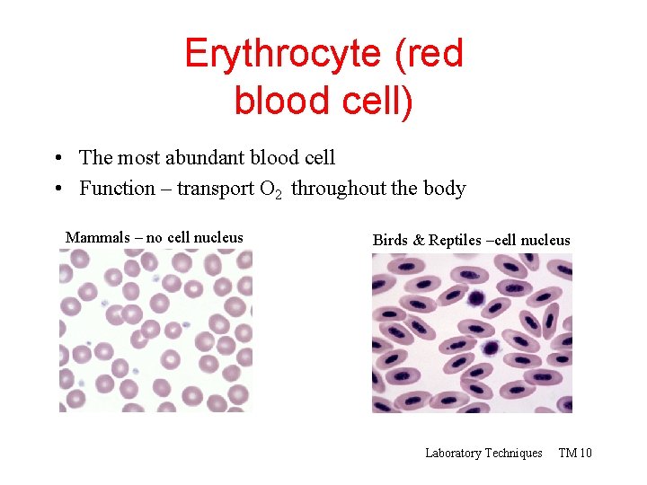 Erythrocyte (red blood cell) • The most abundant blood cell • Function – transport
