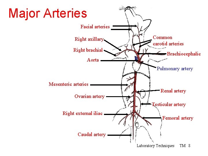 Major Arteries Facial arteries Right axillary Right brachial Common carotid arteries Brachiocephalic Aorta Pulmonary