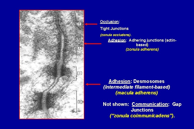 Occlusion: Tight Junctions (zonula occludens). Adhesion: Adhering junctions (actinbased) (zonula adherens) Adhesion: Desmosomes (intermediate