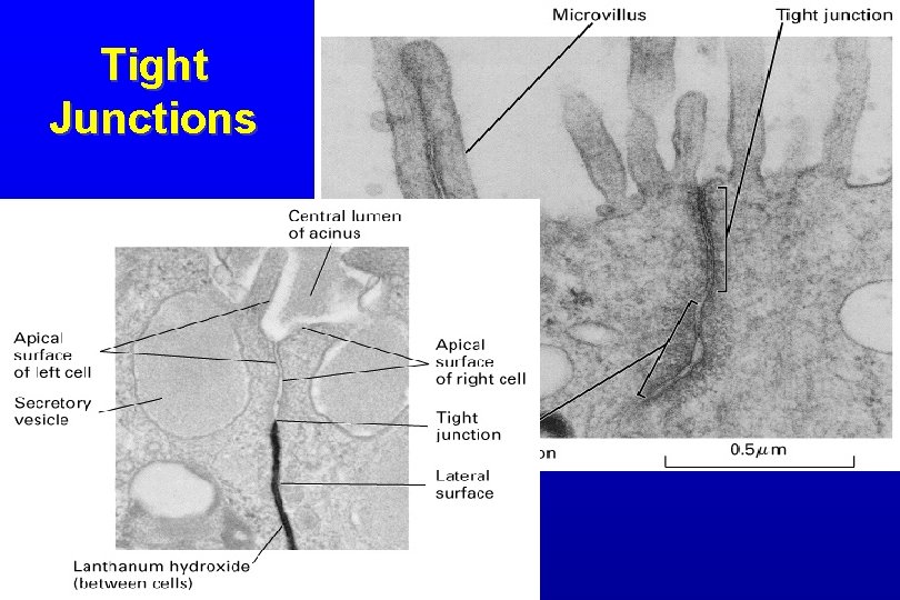 Tight Junctions 