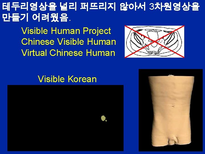 테두리영상을 널리 퍼뜨리지 않아서 3차원영상을 만들기 어려웠음. Visible Human Project Chinese Visible Human Virtual