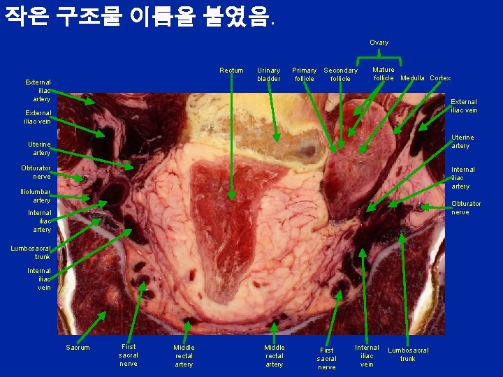 작은 구조물 이름을 붙였음. Ovary Rectum External iliac artery Urinary bladder Primary follicle Secondary