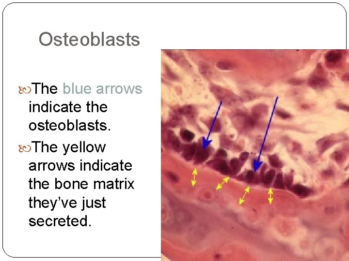 Osteoblasts The blue arrows indicate the osteoblasts. The yellow arrows indicate the bone matrix