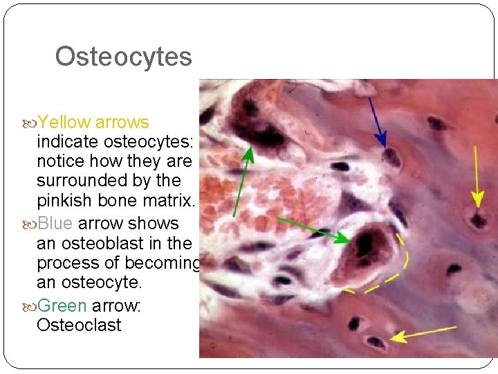 Osteocytes Yellow arrows indicate osteocytes: notice how they are surrounded by the pinkish bone