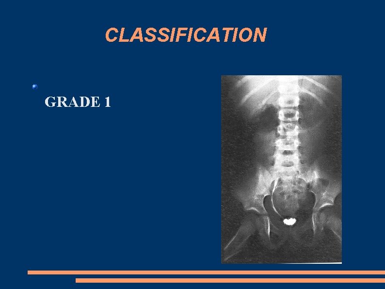 CLASSIFICATION GRADE 1 