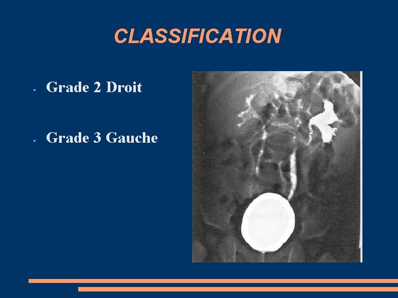 CLASSIFICATION Grade 2 Droit Grade 3 Gauche 