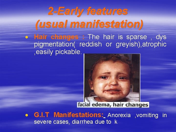 2 -Early features (usual manifestation) Hair changes : The hair is sparse , dys