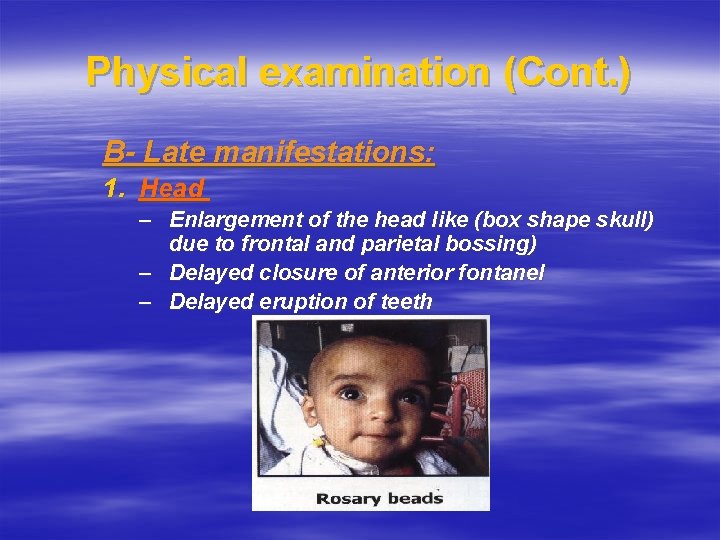 Physical examination (Cont. ) B- Late manifestations: 1. Head – Enlargement of the head