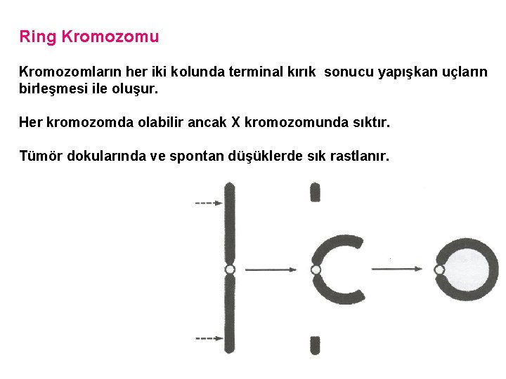 Ring Kromozomu Kromozomların her iki kolunda terminal kırık sonucu yapışkan uçların birleşmesi ile oluşur.