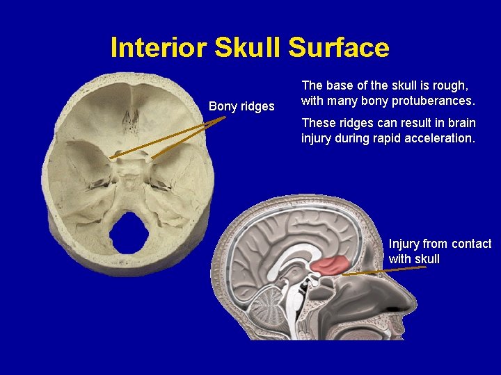 Interior Skull Surface Bony ridges The base of the skull is rough, with many