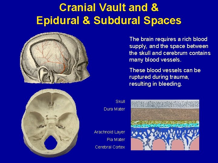 Cranial Vault and & Epidural & Subdural Spaces The brain requires a rich blood